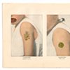 Composition with Disease and Affect