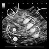 Sonogram Drawings