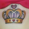 Emma's (lines are healed)