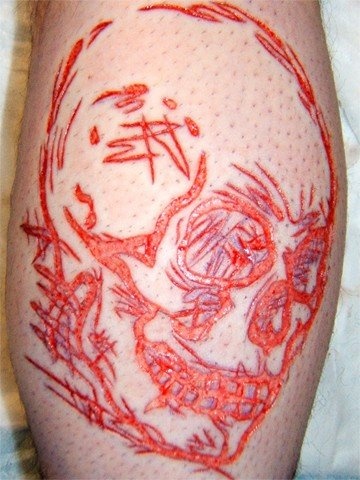 Skull cutting, skin peeling and etching