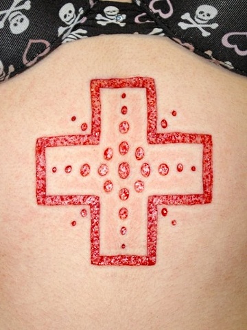 Cross skin peeling