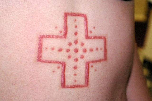 Cross skin peeling