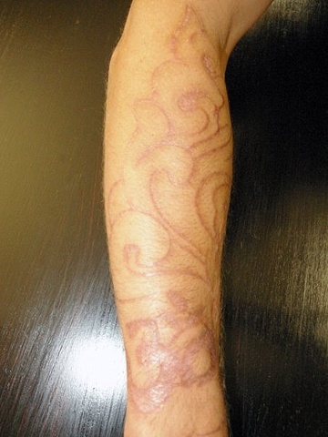 Aum and clouds cutting and skin peeling