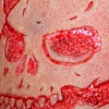 Cutting, peeling and cross hatching