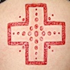 Cross skin peeling