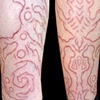 Bio organic collaborative scarification
