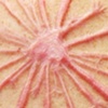 Dandelion scarification
