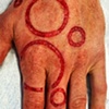 Circles skin peeling