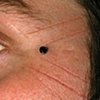 Healed facial cutting