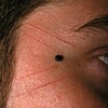 Healed facial cutting