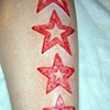 stars skin peeling