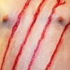 Scratches
