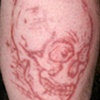 Skull cutting, skin peeling and etching