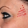 Facial skin peeling