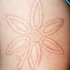 Flower skin peeling