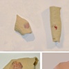 Wound Studies