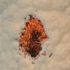 Scabbed arm (close-up)