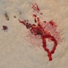 Bleeding shin (close-up)
