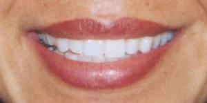 lou s tattoos clearwater florida lips after lou s tattoos clearwater florida lips after