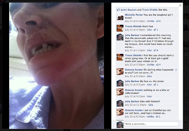 Pictures on facebook of my crash