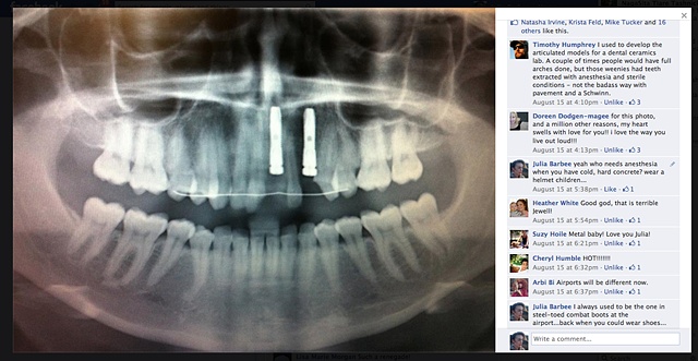 Pictures on facebook of my crash