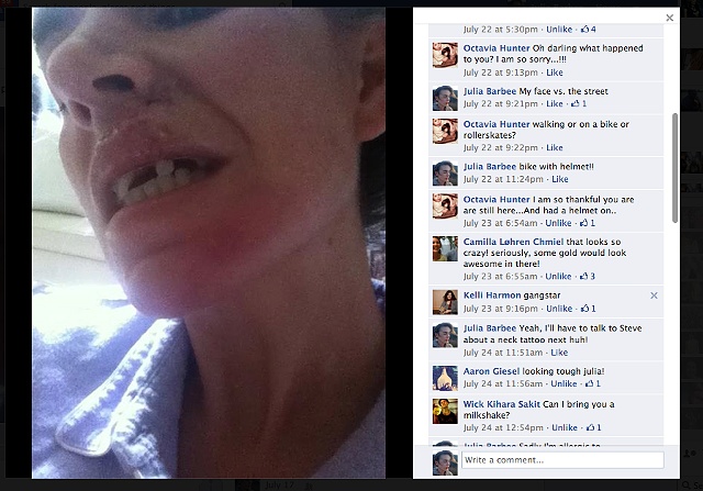 Pictures on facebook of my crash