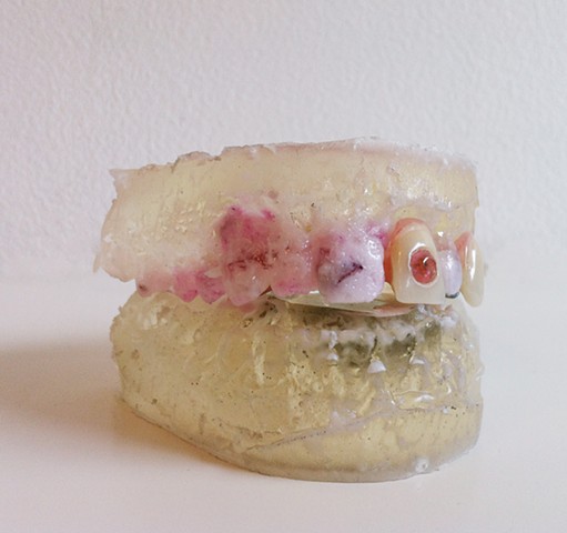Retainer in Resin Casting