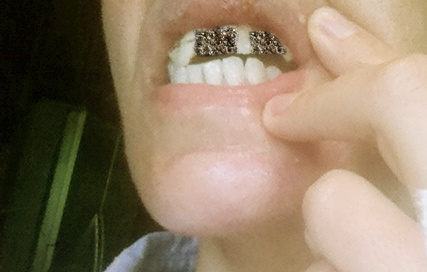 Crystals as Teeth