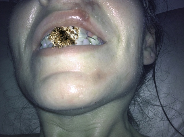 Crystals as Teeth