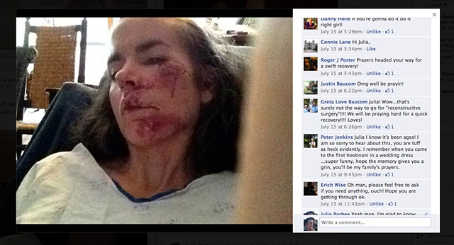 Pictures on facebook of my crash