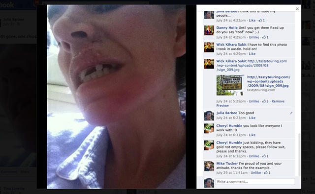 Pictures on facebook of my crash