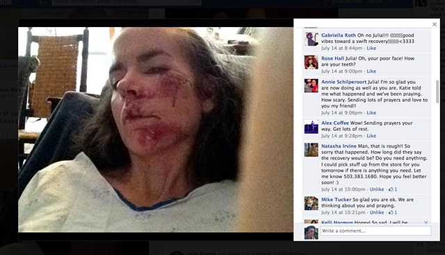 Pictures on facebook of my crash