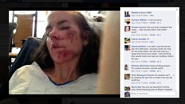 Pictures on facebook of my crash