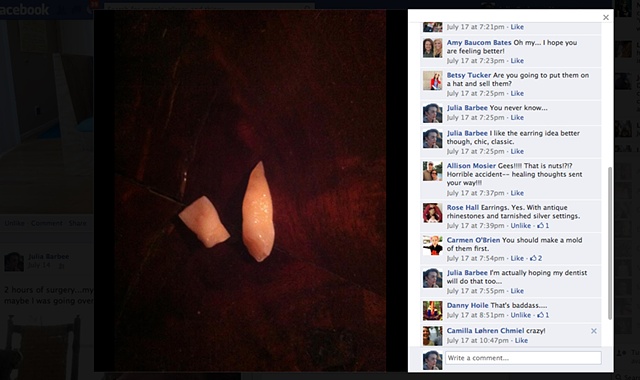 Pictures on facebook of my crash