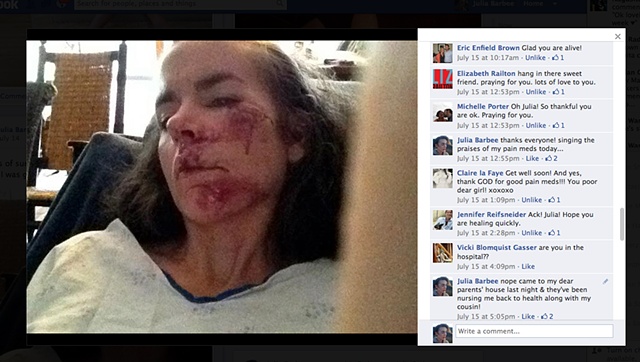 Pictures on facebook of my crash