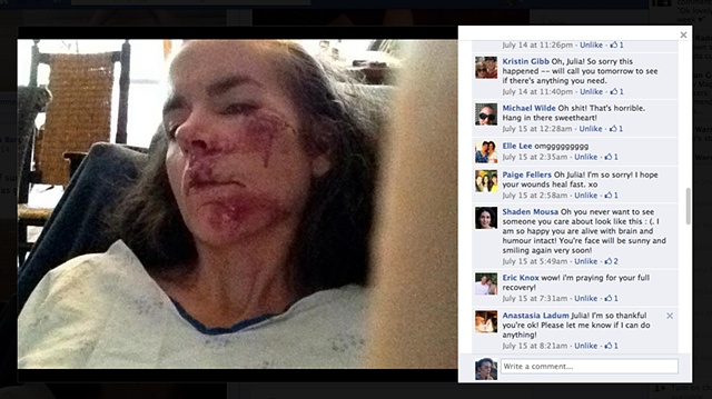 Pictures on facebook of my crash