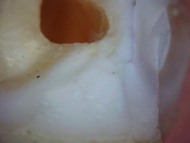 MIcroscopic photo of tooth 