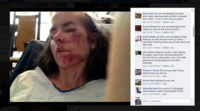 Pictures on facebook of my crash