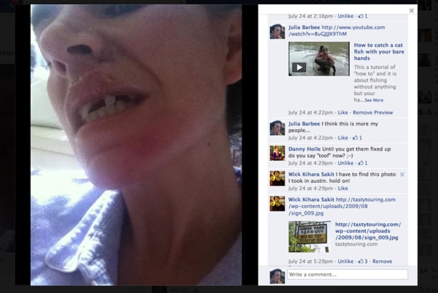 Pictures on facebook of my crash