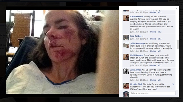 Pictures on facebook of my crash