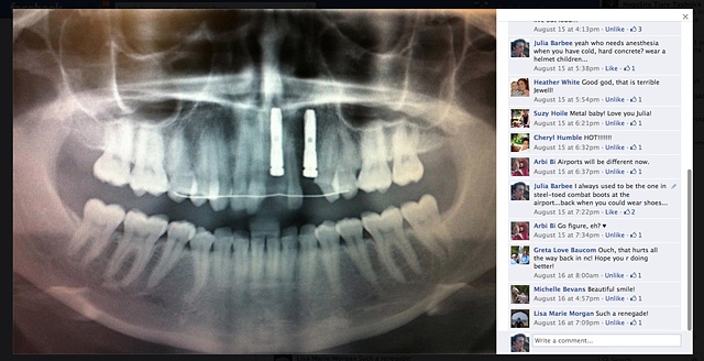 Pictures on facebook of my crash