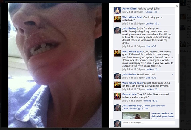 Pictures on facebook of my crash
