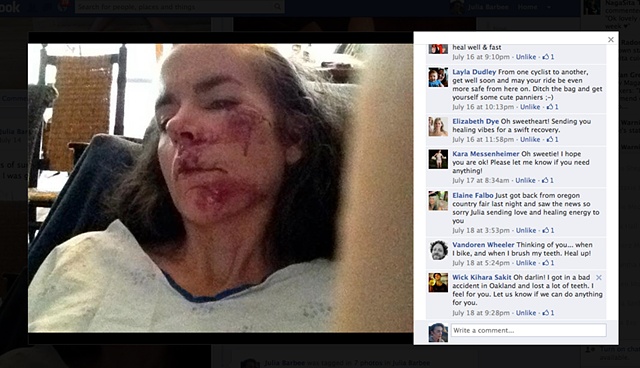 Pictures on facebook of my crash