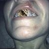 Oral portrait #3