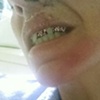 Oral portrait #2