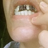 Oral portrait #1