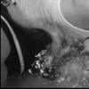 Waterboard