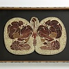 Male Pelvis