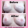 3-D nipple tattoo