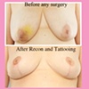 nipple areola tattoo
